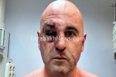leader-of-georgia’s-largest-opposition-party-beaten-by-police-at-rally